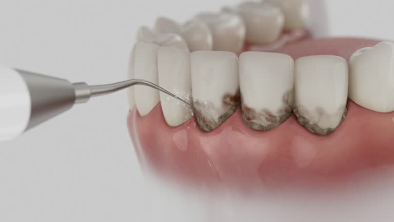 Trusted Tooth Extraction service in Farmville, NC - Dentist Open Now